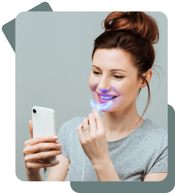 Tẩy trắng răng tại nhà bằng máy: Có nên hay không? – Phân tích học thuật và lời khuyên chuyên sâu